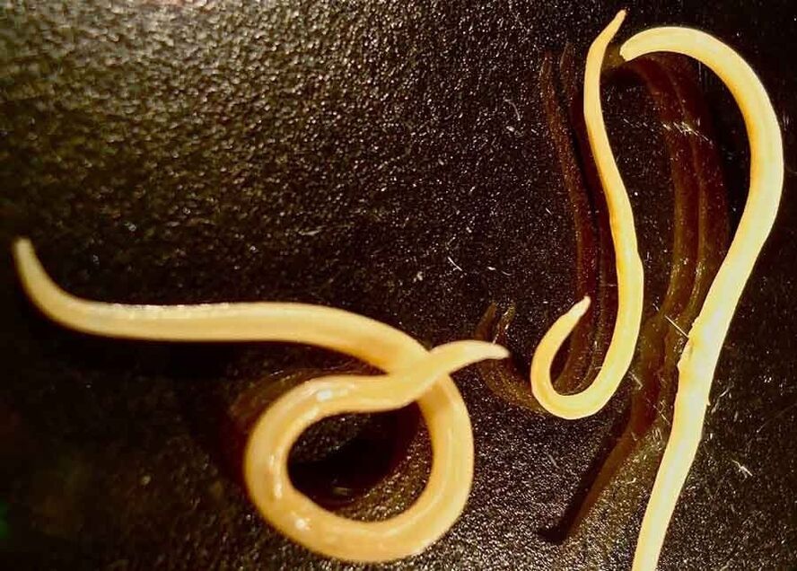 Intestinal worms in the human body