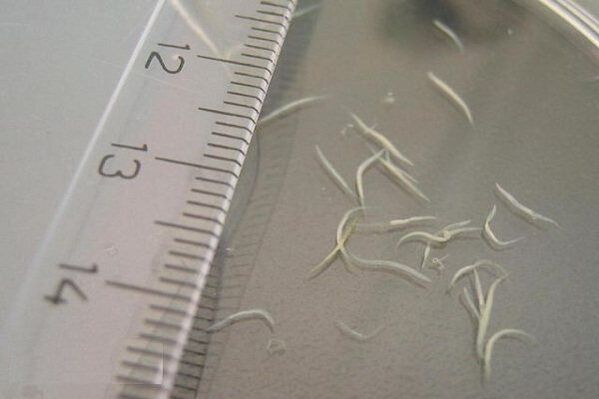 what pinworms look like