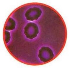 Red blood cell stress