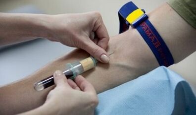 How to prepare for the parasite test
