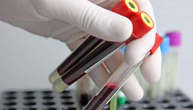 How to take tests of parasites in the body