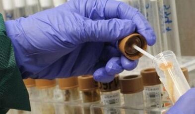 The need to pass the parasites analysis