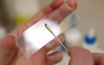 What evidence should be taken for parasites
