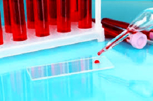Blood exam
