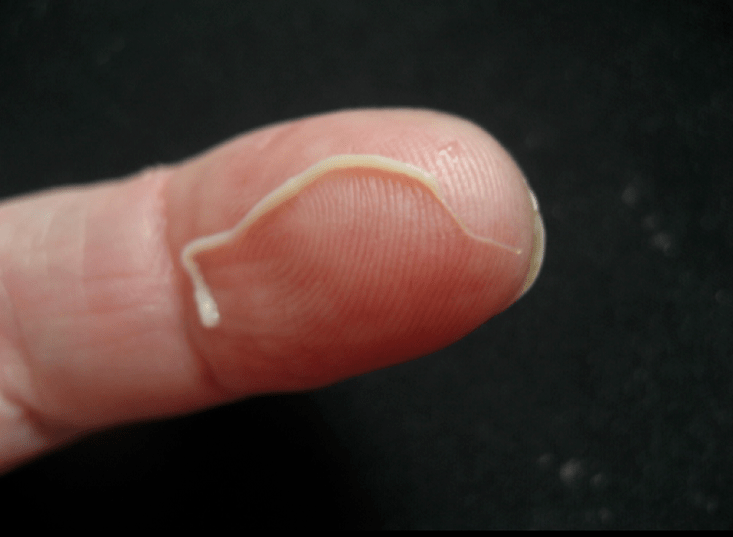 roundworm parasite of the human body