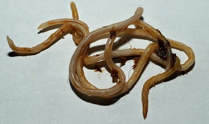 toxocara of the human body